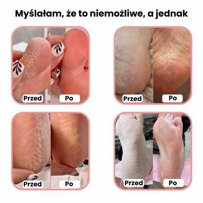 ✨ Infinity™ – zestaw do pielęgnacji stóp