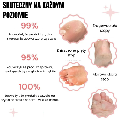 ✨ Infinity™ – zestaw do pielęgnacji stóp